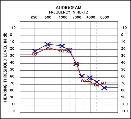 Avdiogram — graf praga sluha pri različnih frekvencah